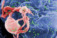 Un micrógrafo electrónico del VIH-1 (Foto: CDC/ C. Goldsmith, P. Feorino, E. L. Palmer, W. R. McManus)