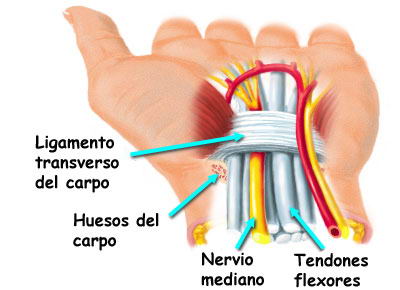 Tunel del carpo (traumawebantequera.com)