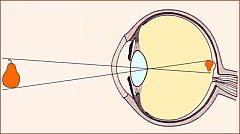Imagen invertida en la retina