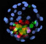 celulas madres de embrión humano (whatsnextnetwork.com)
