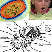 Bordetella pertussis 