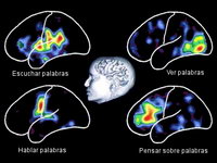 Scan mostrando las areas del cerebro involucradas en tareas verbales