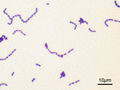 Imagen microscópica de Streptococcus mutans ATCC 25175. Tinción de Gram. 1000 aumentos (es.wikipedia.org)