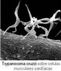 Trypanosoma cruzi sobre el corazón (Imagen: alcha.org.ar)