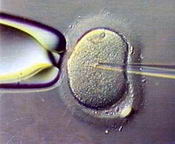 Fecundación in vitro