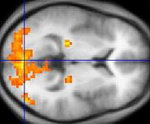 MRI funcional mostrando regiones de activación en naranja (Foto: wikipedia.org)