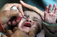 Vacunación oral. Actualmente se recomienda la vacuna inyectada.