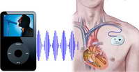 Diagrama efecto iPod sobre marcapasos (Foto: techshout.com)